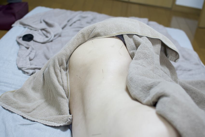 妊婦さんのための腰と臀部への鍼治療