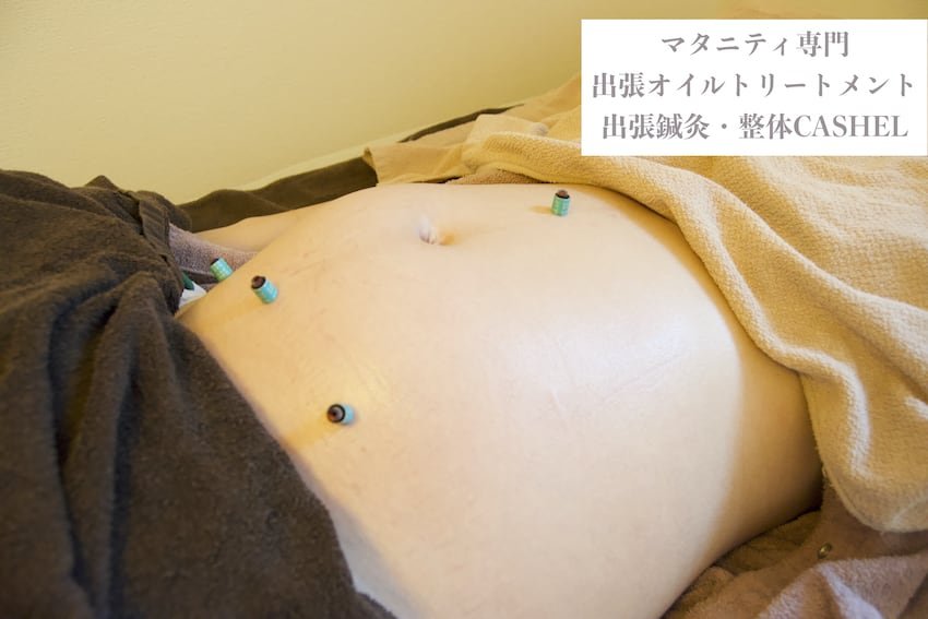 東京の妊娠7ヶ月の妊婦さんのお腹への実際のお客様へのお灸治療中のお写真です